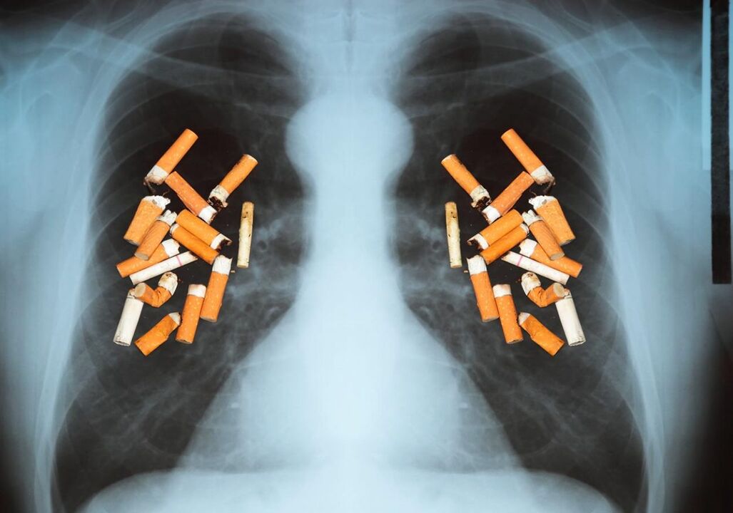 Comme les cigarettes affectent les poumons